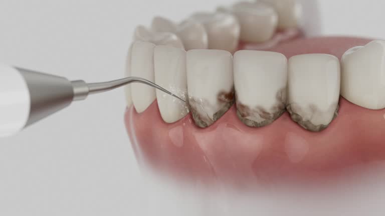 Trusted Emergency Dentist service in Jackson, OH - Dentist Open Now